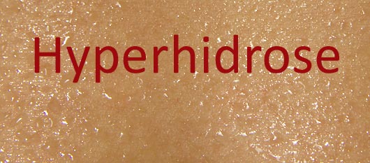 Hyperhidrose  - Schwitzende Haut